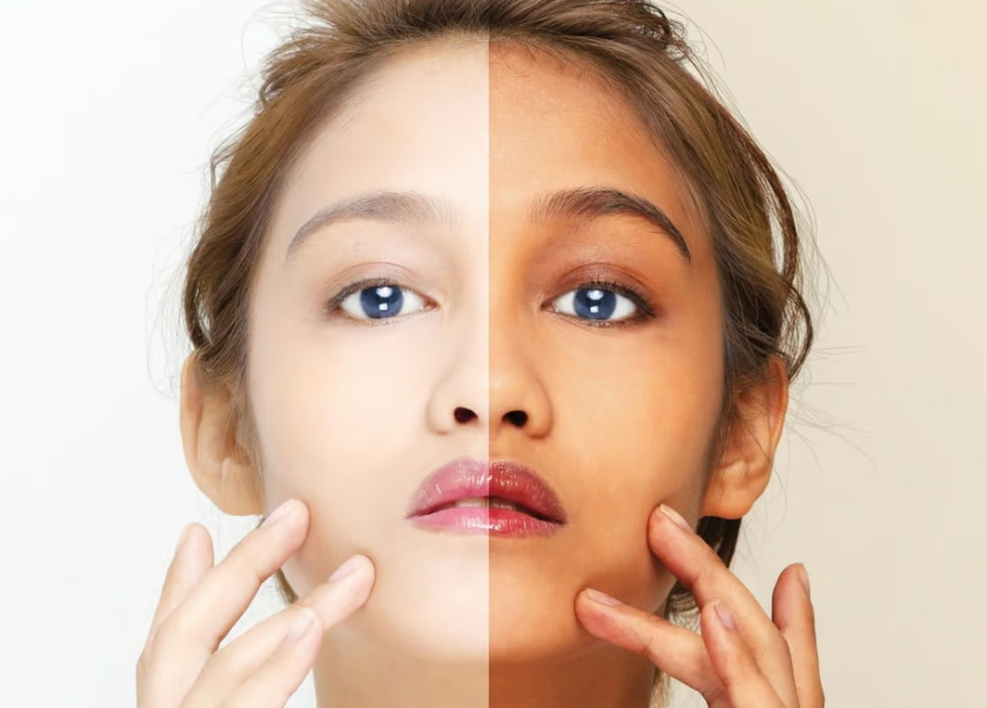 Skin colour changed