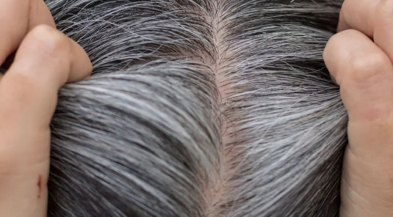 White hair Treatments