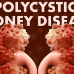 Polycystic Kidney Disease