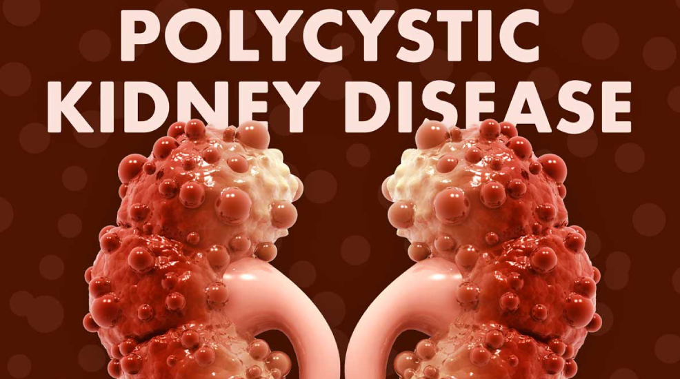 Polycystic Kidney Disease