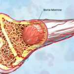 bone-marrow