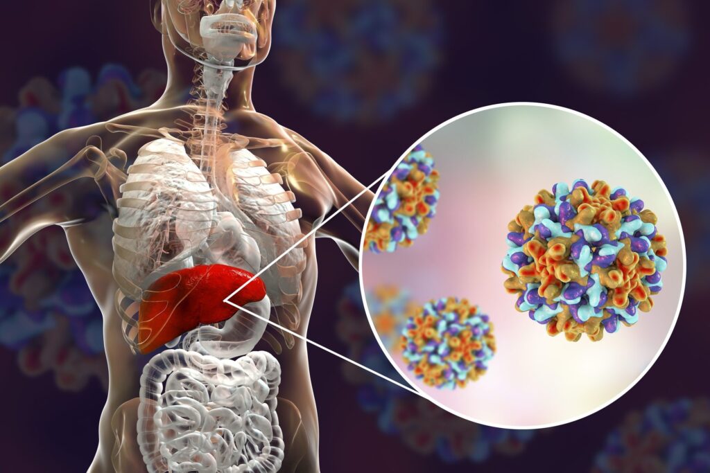 Hepatitis B
