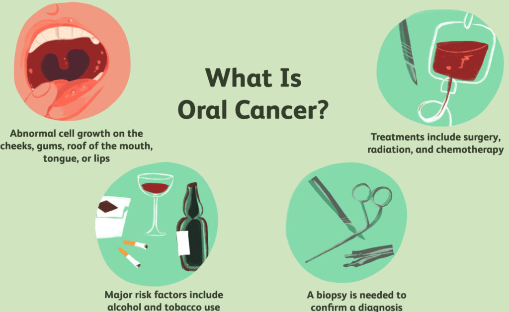oral cancer
