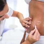 Fat Removal