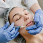 Lip Filler