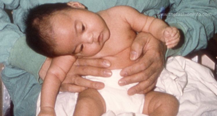 What Is Infant Botulism